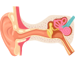 달팽이관 손상
